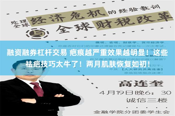 融资融券杠杆交易 疤痕越严重效果越明显！这些祛疤技巧太牛了！两月肌肤恢复如初！